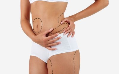 Tratamientos Qualyderm