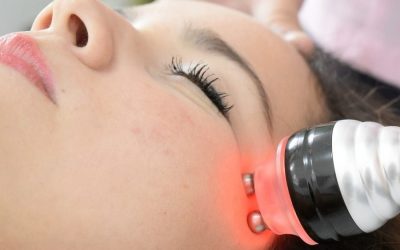 Fotorejuvenecimiento